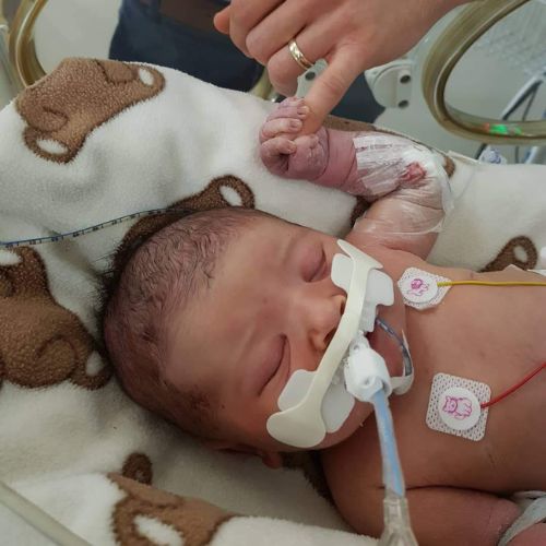 NICU isn’t just for premature babies